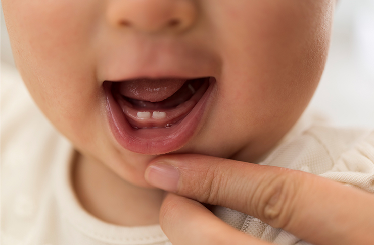 ３歳までが勝負 赤ちゃんの歯を虫歯から守るには Pinto スタジオアリス